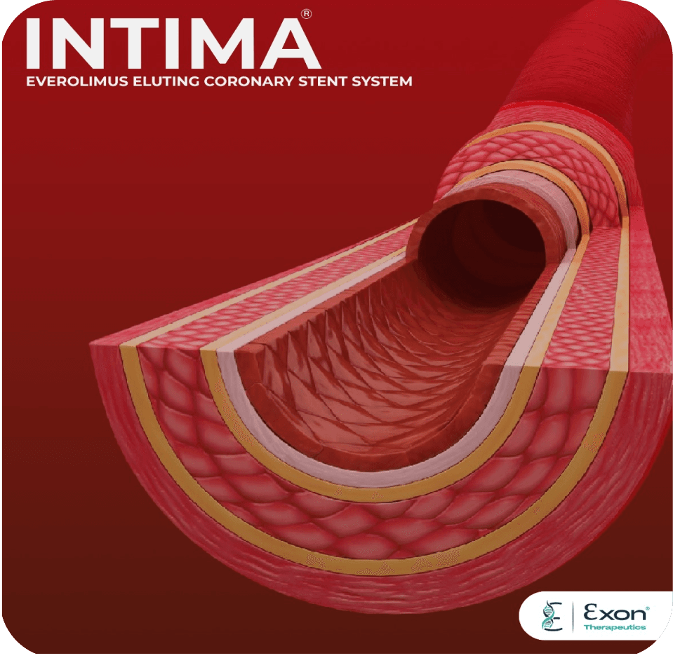 Exon Therapeutics INTIMA